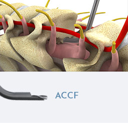 ACCF