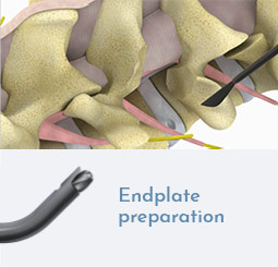 Endplate preparation